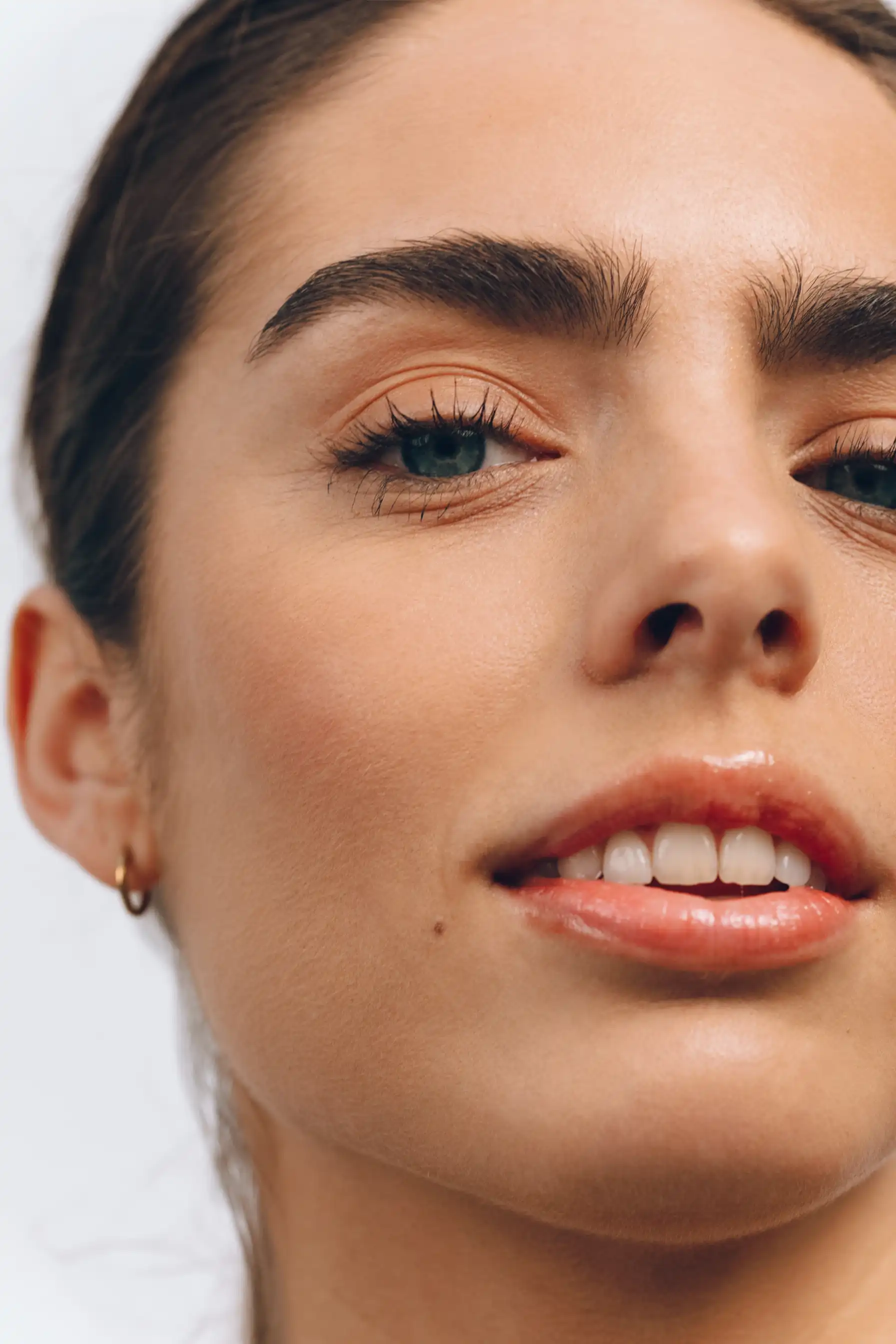 botox behandeling bij fairday