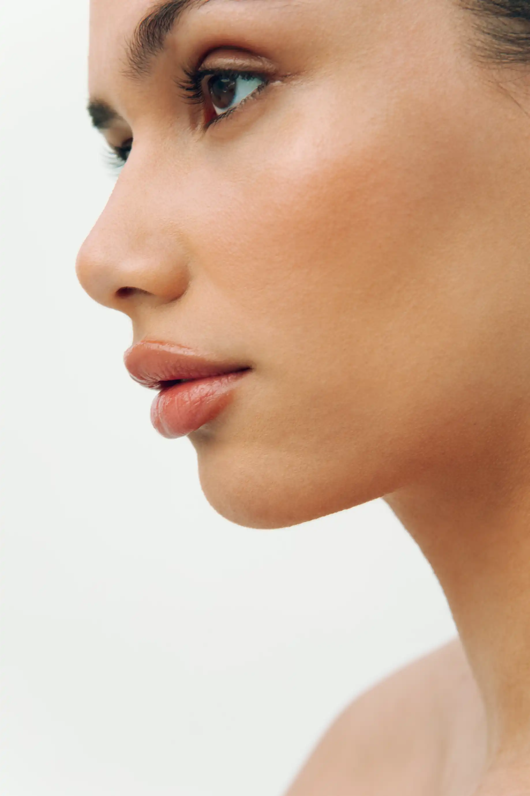 lip fillers voor en na