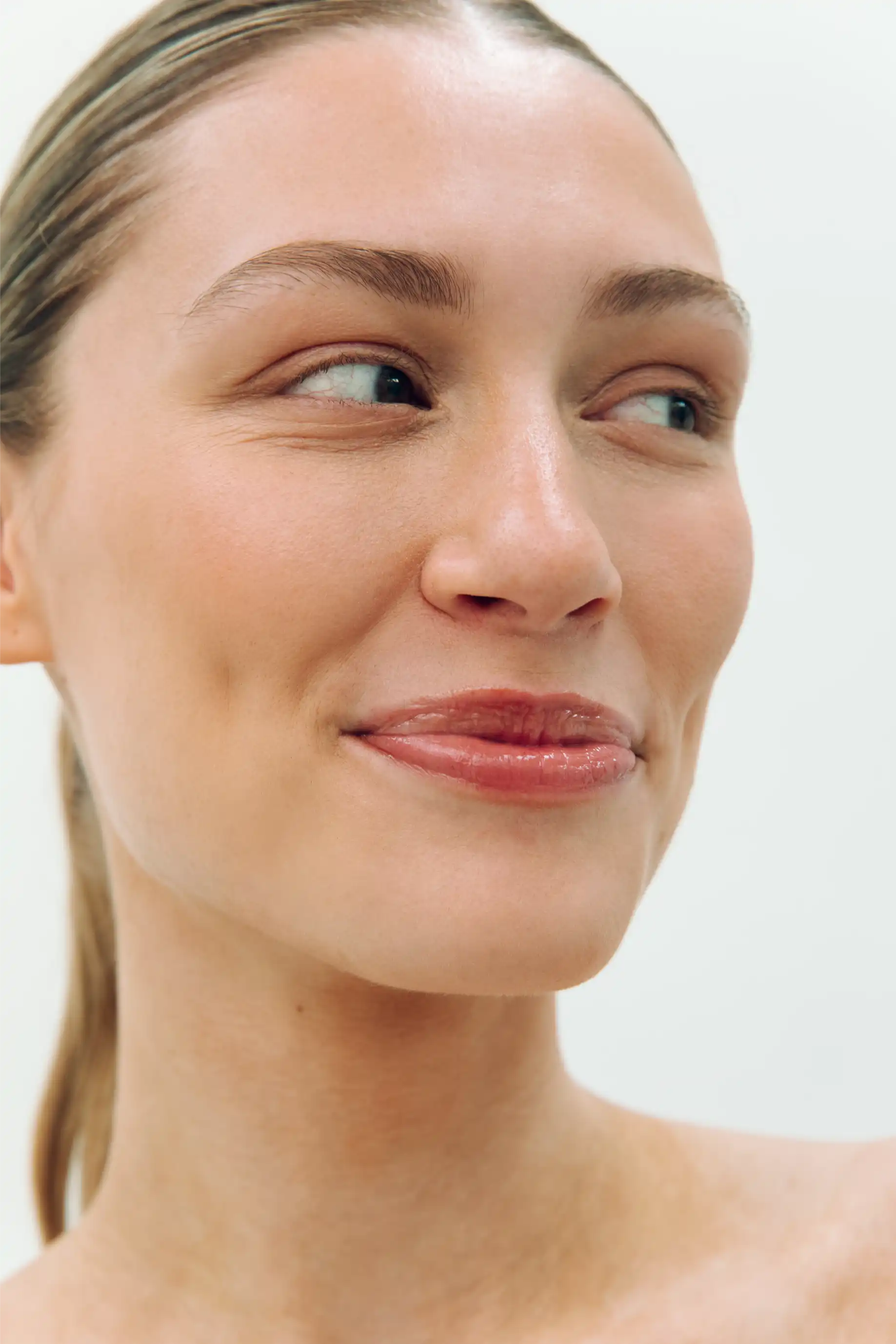 huidversteviging door sculptra bij fairday clinics