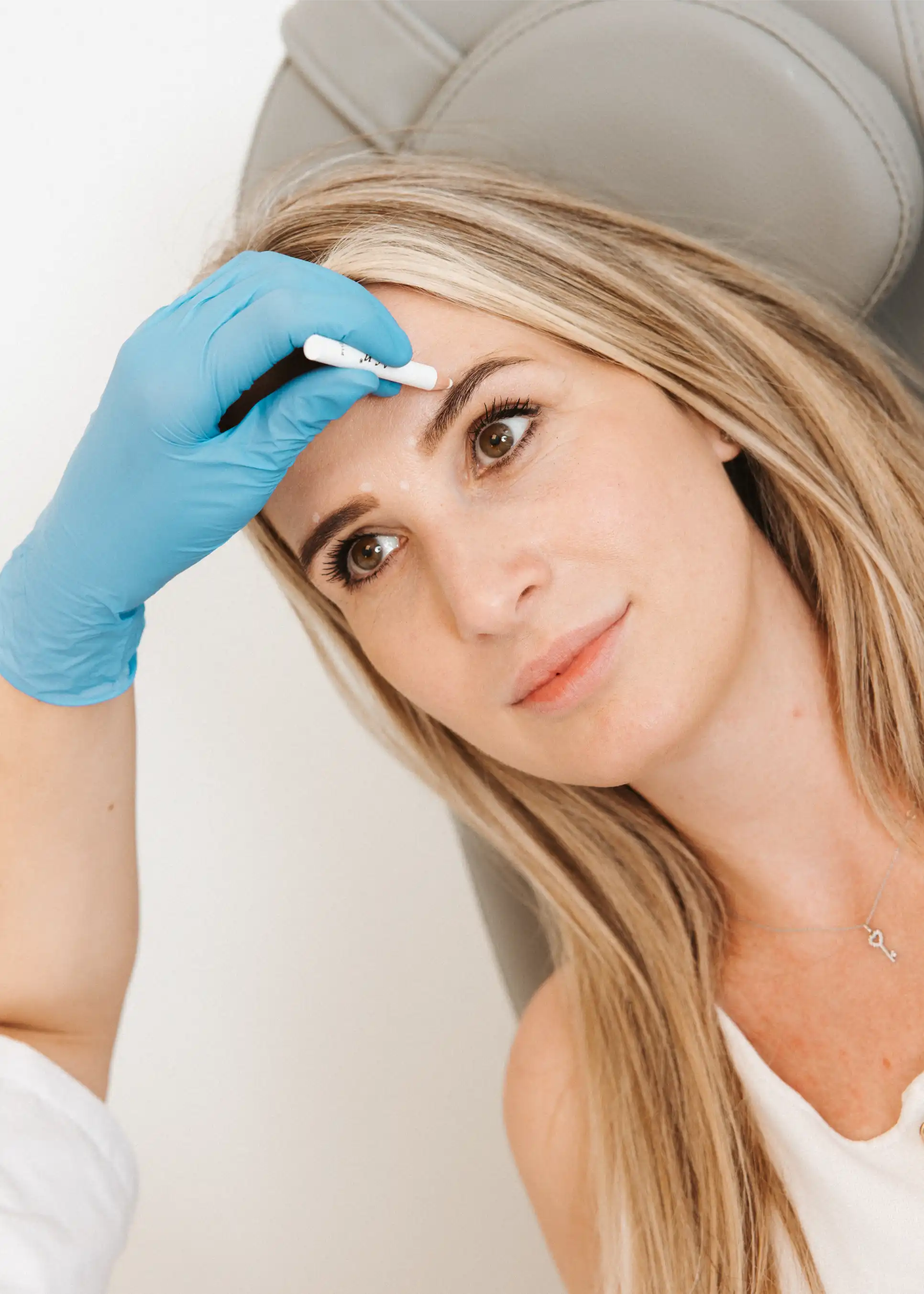 resultaat botox bij fairday