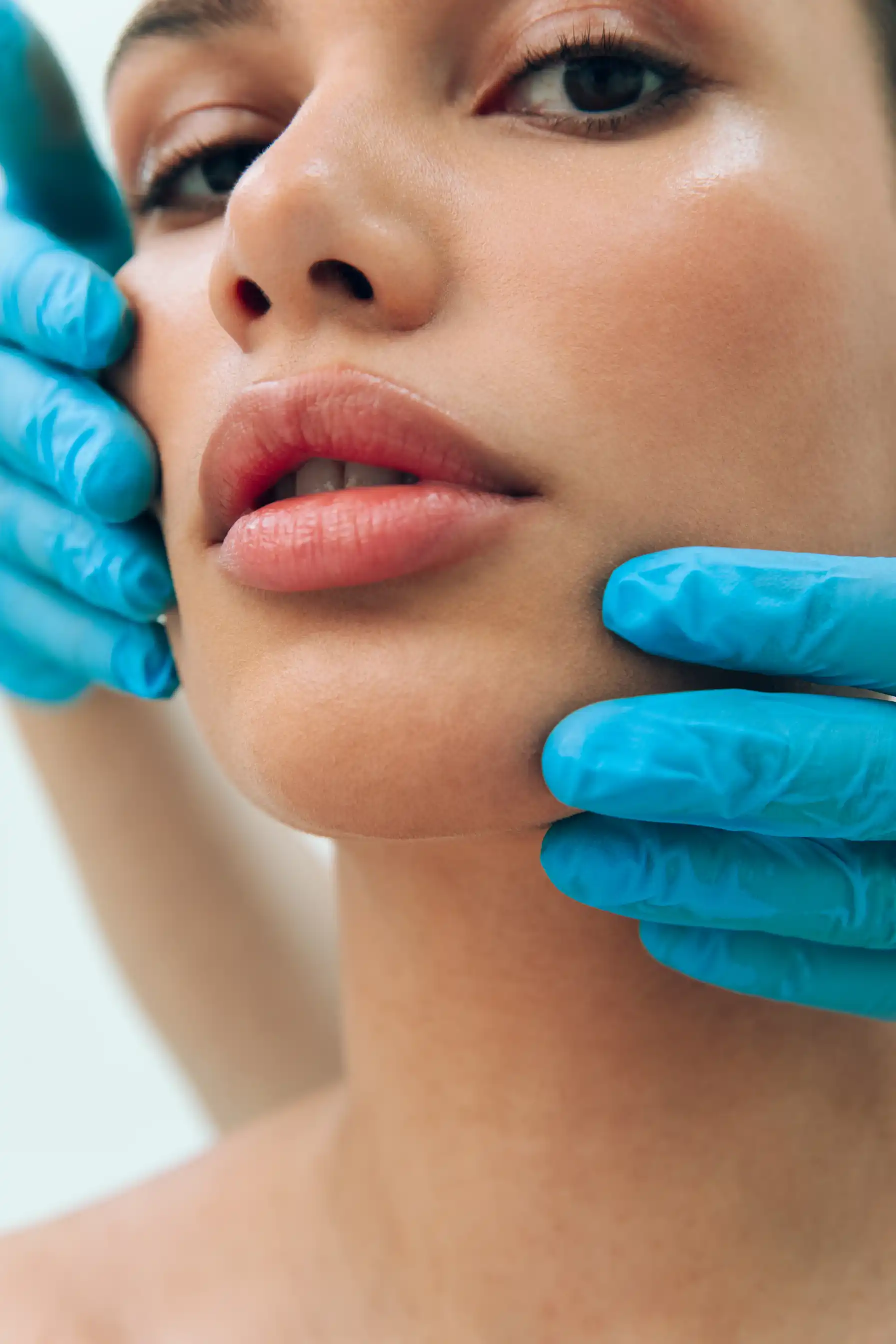 mooi lip filler resultaat bij fairday clinics