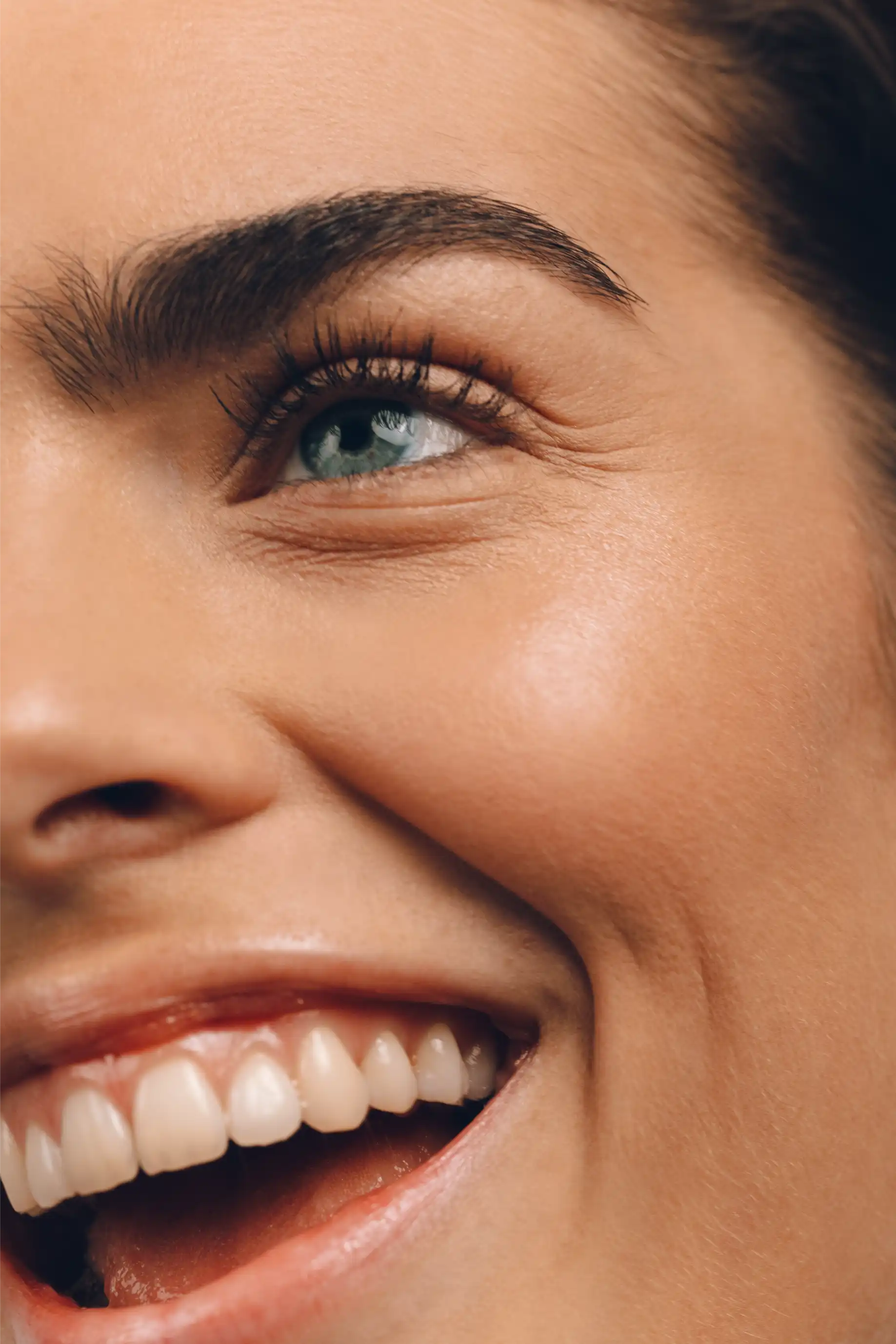 resultaat fillers Almere